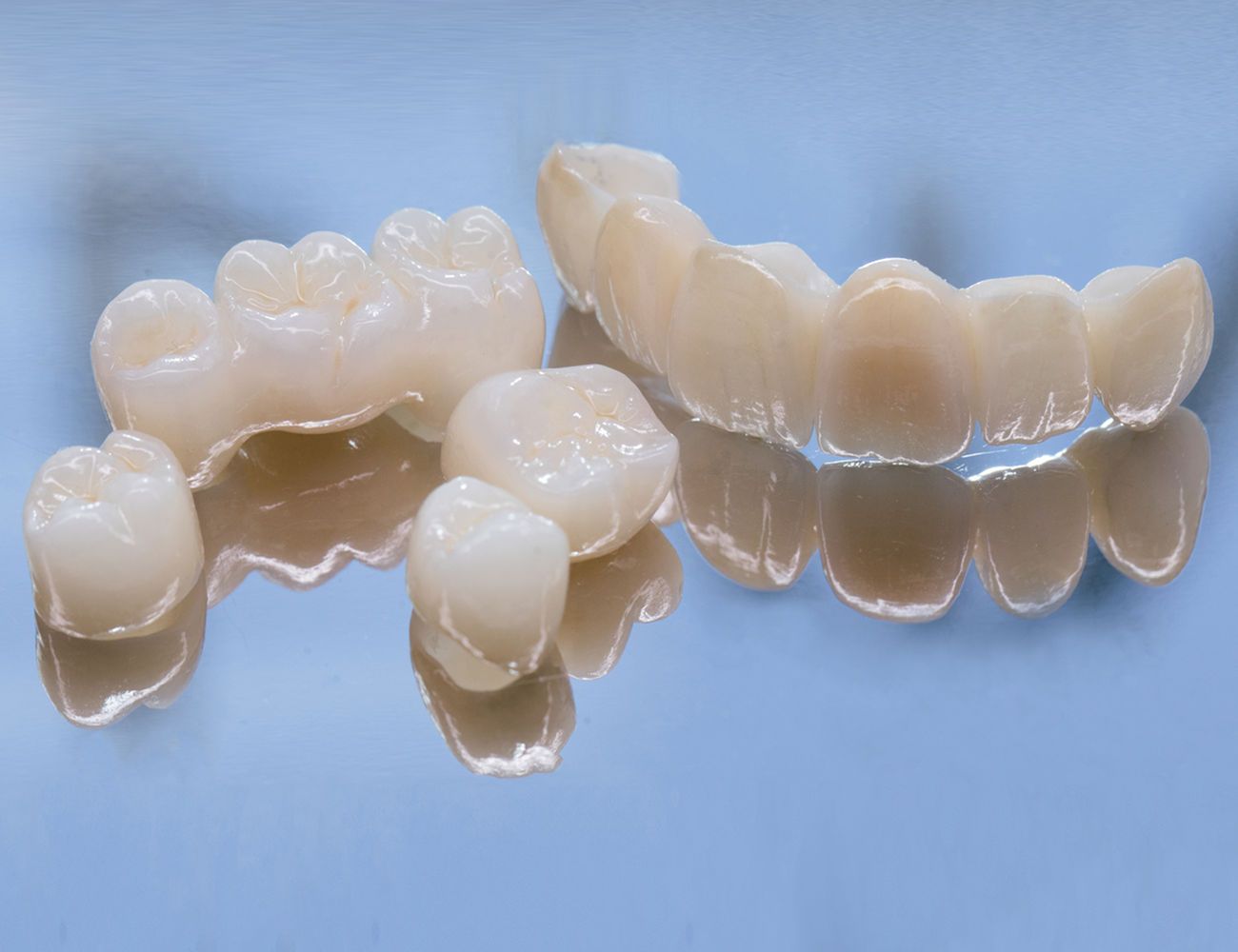 Αισθητική οδοντιατρική - Ολοκεραμικές στεφάνες